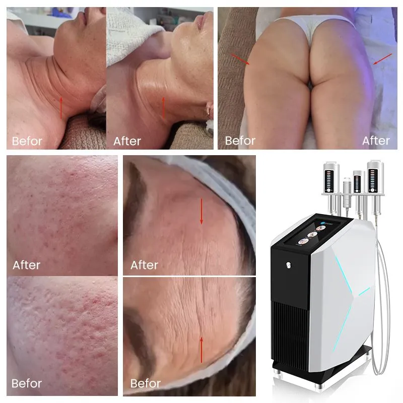 Endospheres Machine Review