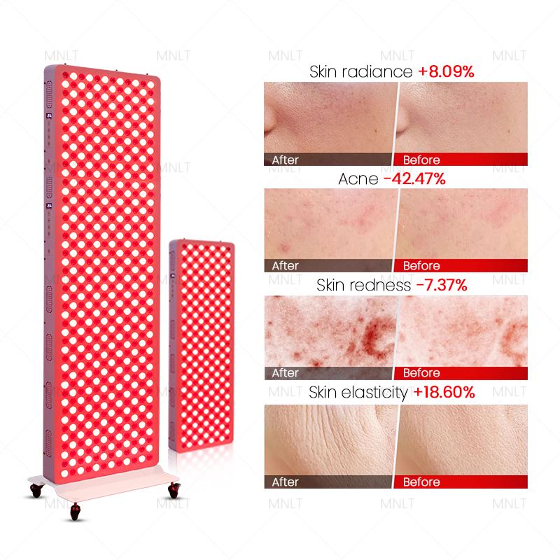 Red Light Beauty oprema - Profesionalna ploča za reljefnu terapiju protiv starenja i boli